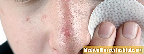 Oksijene benzoil ak erythromycin aktualite (Aktipak, Benzamycin, Benzamycin Pak)