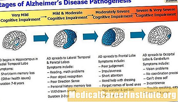 Quiz na temat choroby Alzheimera: etapy, objawy i objawy