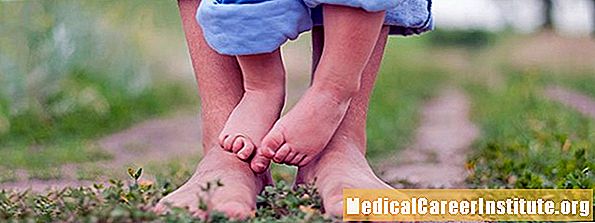 Bunions