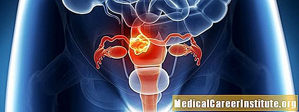 Rahim Fibroidleri