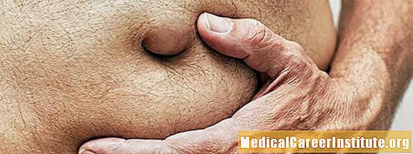 Hernia hiatala