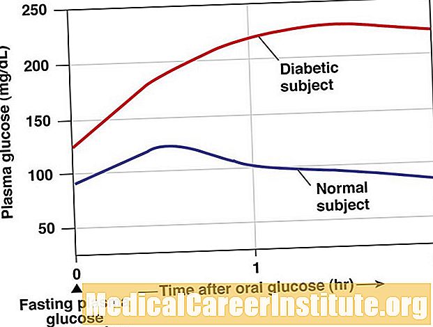 Hoe worden glucosetolerantietesten gebruikt om diabetes te diagnosticeren?