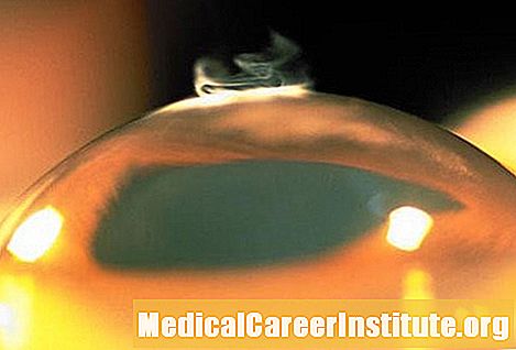 LASIK Øyekirurgi: Bedre syn med laserkirurgi