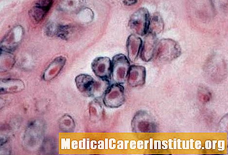 Zoster Rash Pictures, Simptome, Fapte despre vaccin - Medicament Despre