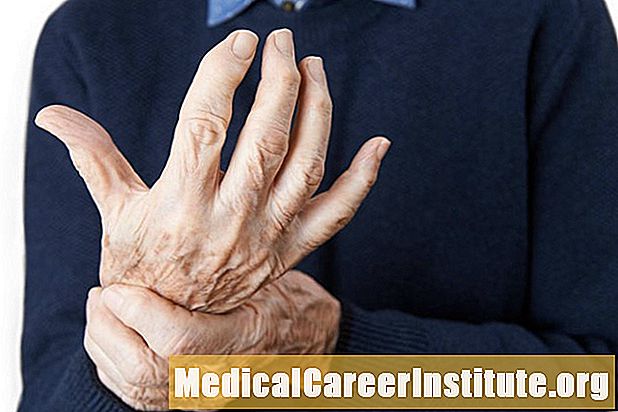 Bidh smocadh a ’meudachadh chunnart arthritis reumatoid