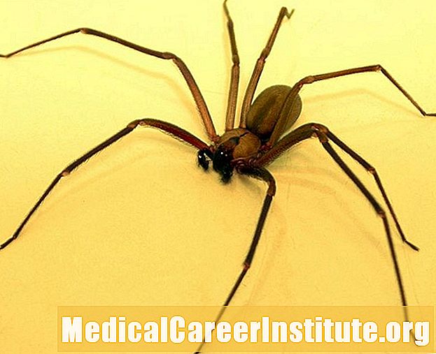 Symptomer og tegn på Brown Recluse Spider Bite - Om Medisin