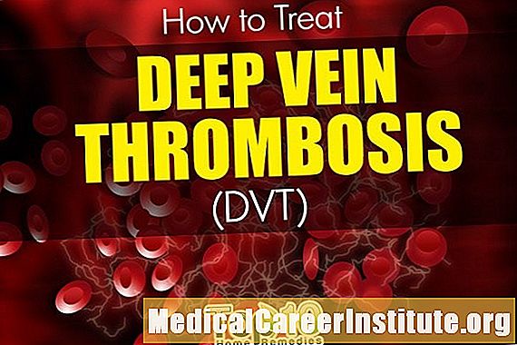 Symptomen en tekens fan DVT (Deep Vein Thrombosis Blood Clot in the Leg)