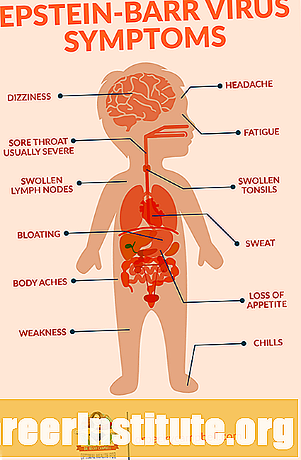 Gejala dan Tanda Virus Epstein-Barr (EPV, Mononucleosis, Mono)