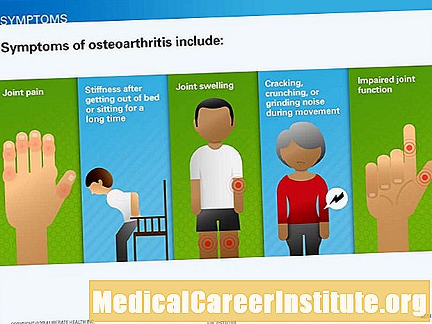 Simptome en tekens van osteoartritis