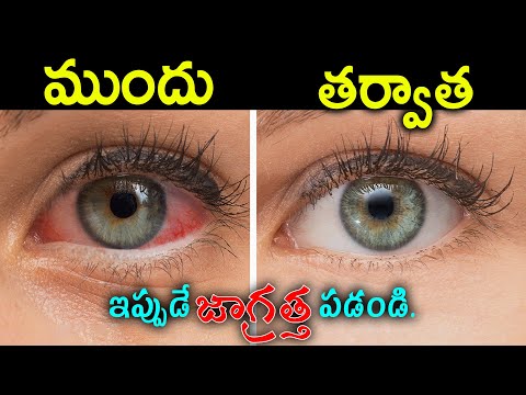 కళ్ళు స్పష్టంగా మరియు కళ్ళను తెల్లగా మార్చే చిట్కాలు ఇలాచేసుకోండి.పొడిబారిన కళ్ళను ఇలా బాగుచేసుకోండి