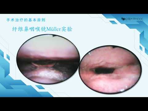 7 2阻塞性睡眠呼吸暂停低通气综合征气道评估
