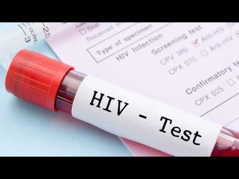 Ukiona dalili hizi 13 katika mwili wako nenda kapime UKIMWI.