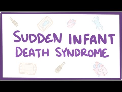 Sudden infant death syndrome (SIDS) - causes, symptoms, diagnosis, treatment, pathology