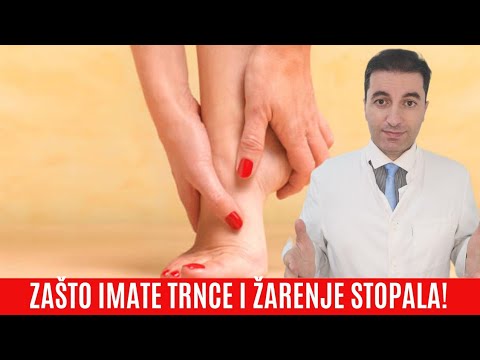 OPREZ! Ovo su GLAVNI RAZLOZI zašto osjećate UTRNUTOST, ŽARENJE, BOL U STOPALU...