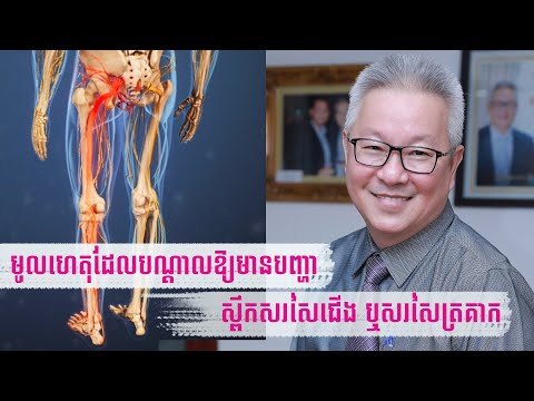 មូលហេតុដែល​បណ្តាលឱ្យ​មានបញ្ហា​ស្ពឹក​សរសៃជើង​ឬត្រគាក​