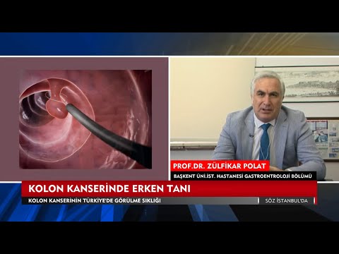 Kolon Kanserinde Erken Tanı ve Tarama Süreci