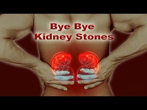 Only 1 ingredient get rid of kidney stones “overnight”