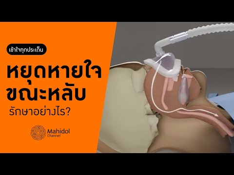 &rsquo;หยุดหายใจขณะหลับ&rsquo; รักษาอย่างไร? [หาหมอ by Mahidol Channel]