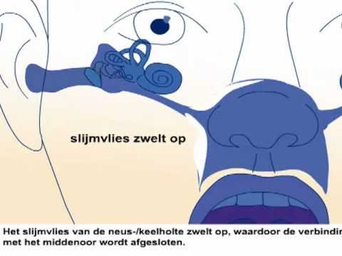 Oorontsteking - Oorzaak en behandeling oorpijn