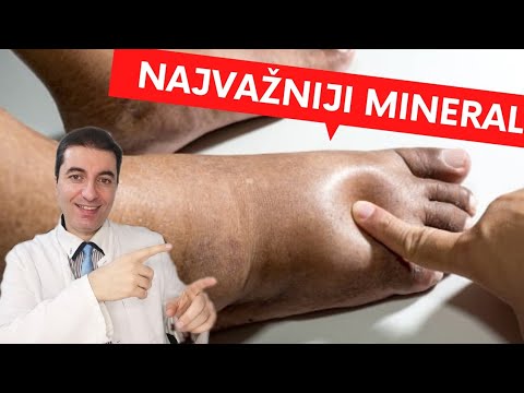 Najvažniji MINERAL za OTEČENE NOGE, NOŽNE ZGLOBOVE I STOPALA!