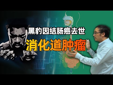 黑豹演员博斯曼因结肠癌去世！普通人如何逃脱消化道肿瘤魔爪？