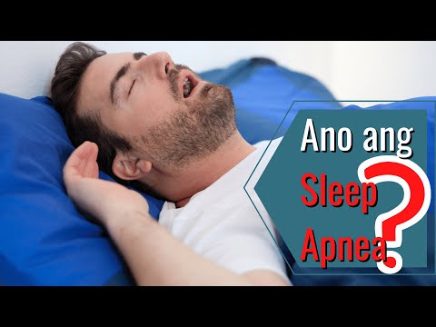 Ano ang Sleep Apnea? Laganap ba ito?