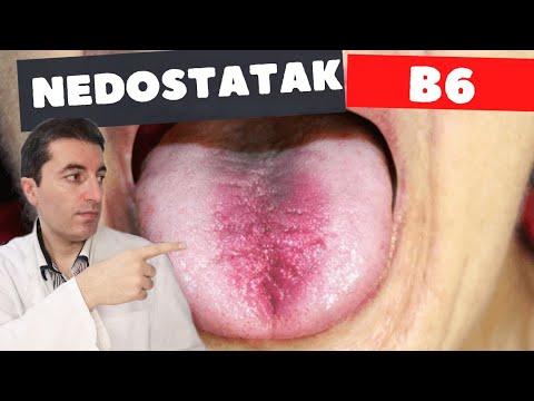 5 jako ČUDNIH i OPASNIH SIMPTOMA NEDOSTATKA VITAMINA B6!