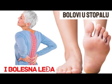 Kada BOLOVI,OTEKLINE,UTRNUTOST STOPALA znače da imate bolesna LEĐA?